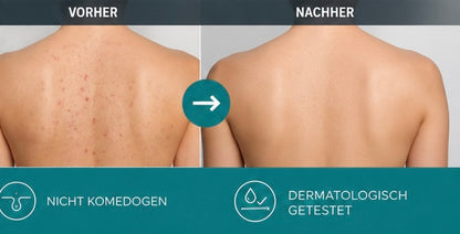 BackClear 2% Salicylsäure Rücken-Akne Spray - 150ml